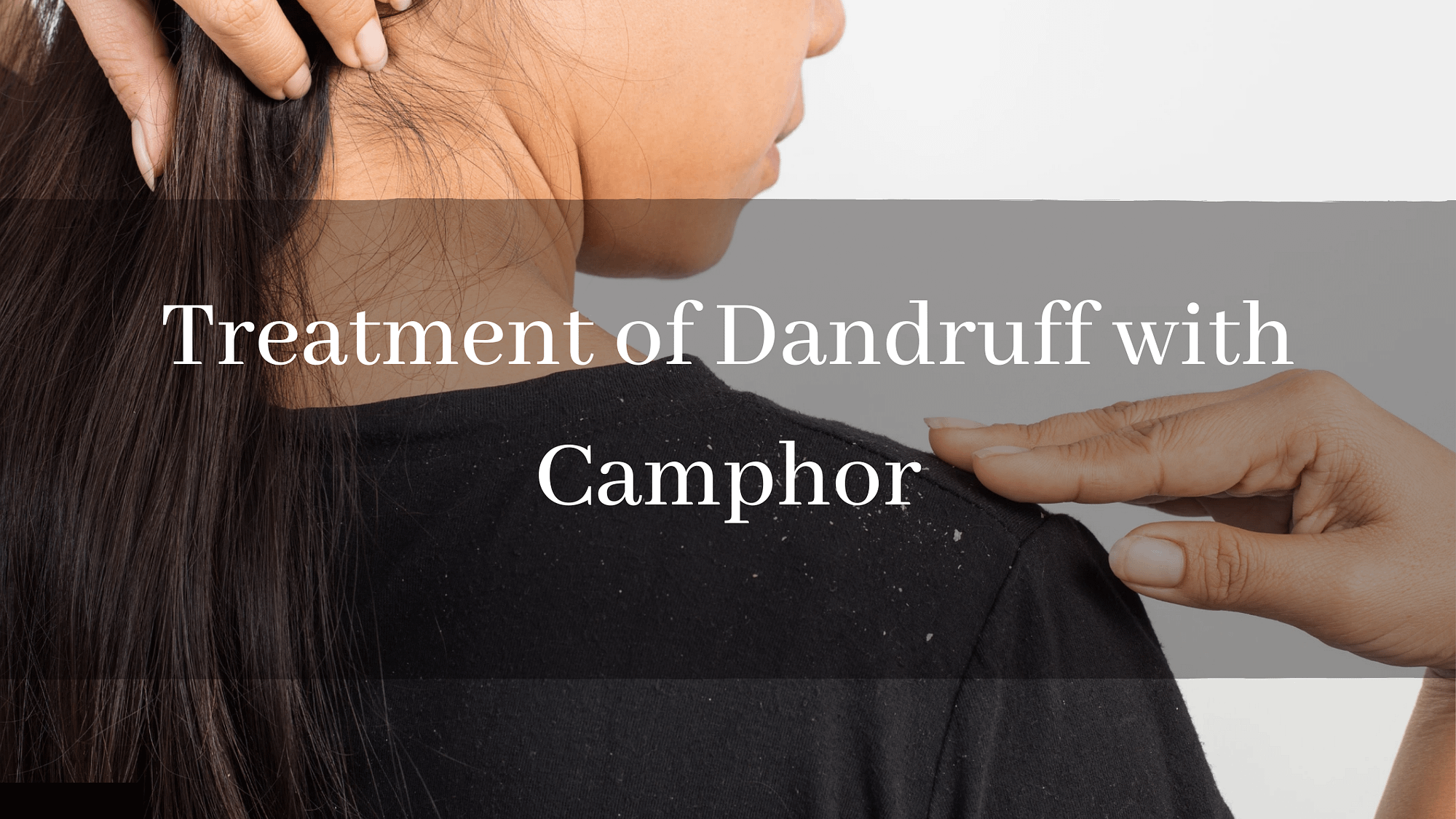 Treatment of Dandruff with Camphor